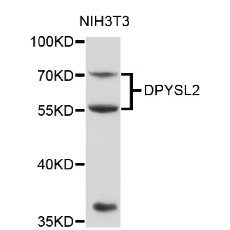 Western Blot - Anti-DPYSL2 Antibody (A0652) - Antibodies.com