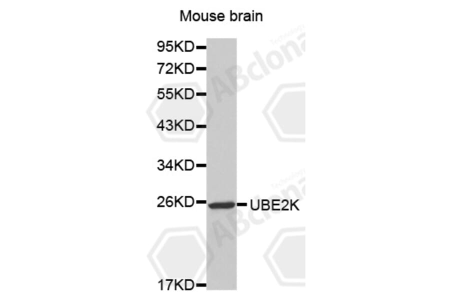 Western Blot - Anti-UBE2K Antibody (A0655) - Antibodies.com