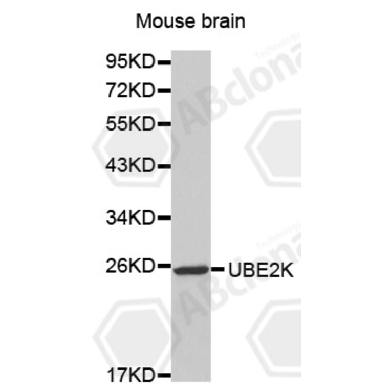 Western Blot - Anti-UBE2K Antibody (A0655) - Antibodies.com