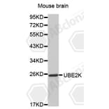 Western Blot - Anti-UBE2K Antibody (A0655) - Antibodies.com