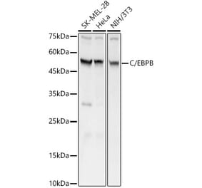 Western Blot - Anti-CEBP Beta Antibody (A11184) - Antibodies.com