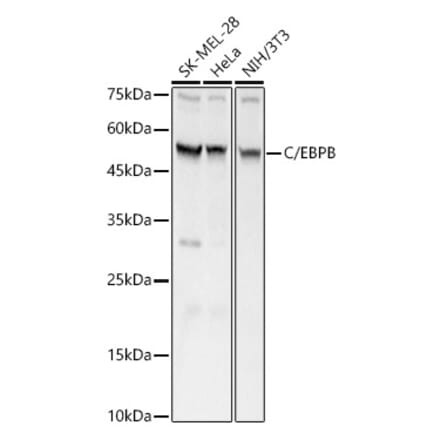 Western Blot - Anti-CEBP Beta Antibody (A11184) - Antibodies.com