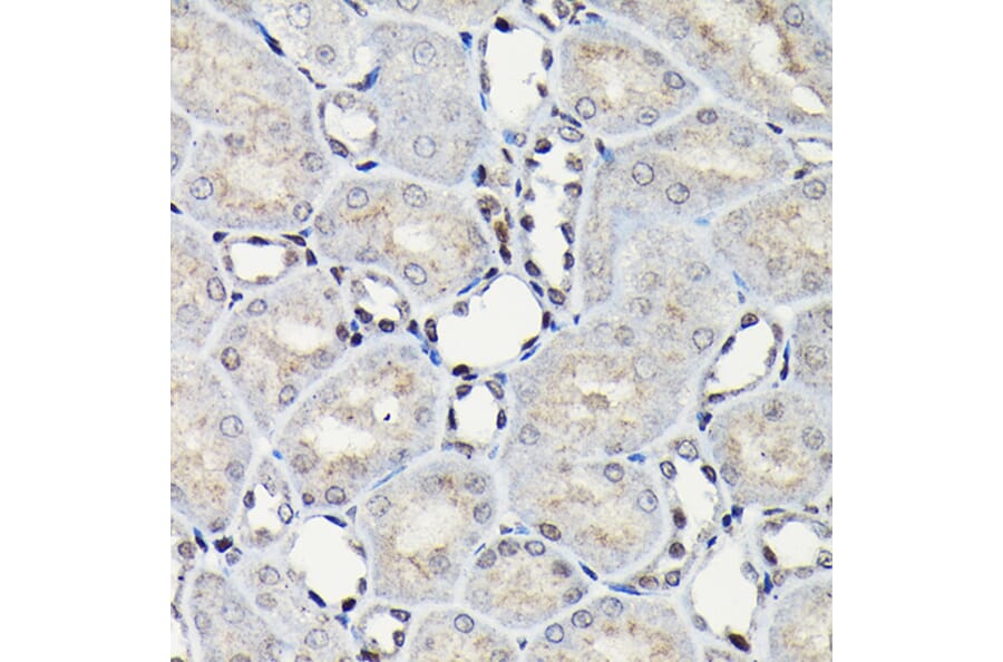 Immunohistochemistry - Anti-CEBP Beta Antibody (A11184) - Antibodies.com