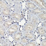 Immunohistochemistry - Anti-CEBP Beta Antibody (A11184) - Antibodies.com