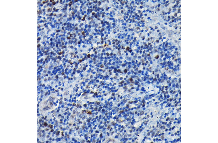 Immunohistochemistry - Anti-CEBP Beta Antibody (A11184) - Antibodies.com