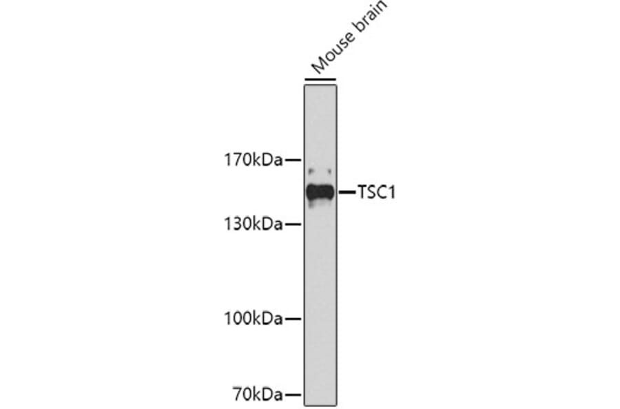 Western Blot - Anti-TSC1 Antibody (A0721) - Antibodies.com