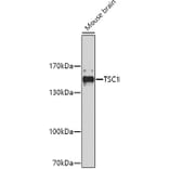 Western Blot - Anti-TSC1 Antibody (A0721) - Antibodies.com