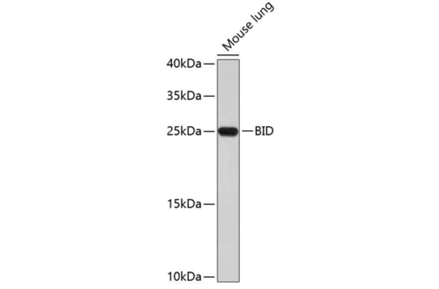 Western Blot - Anti-BID Antibody (A0728) - Antibodies.com