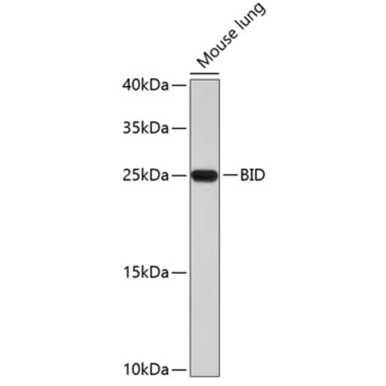 Western Blot - Anti-BID Antibody (A0728) - Antibodies.com