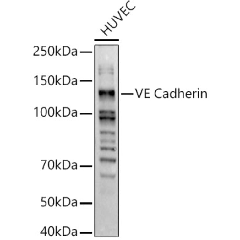 Western Blot - Anti-VE Cadherin Antibody (A11187) - Antibodies.com