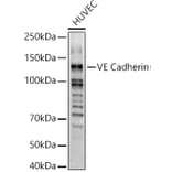 Western Blot - Anti-VE Cadherin Antibody (A11187) - Antibodies.com