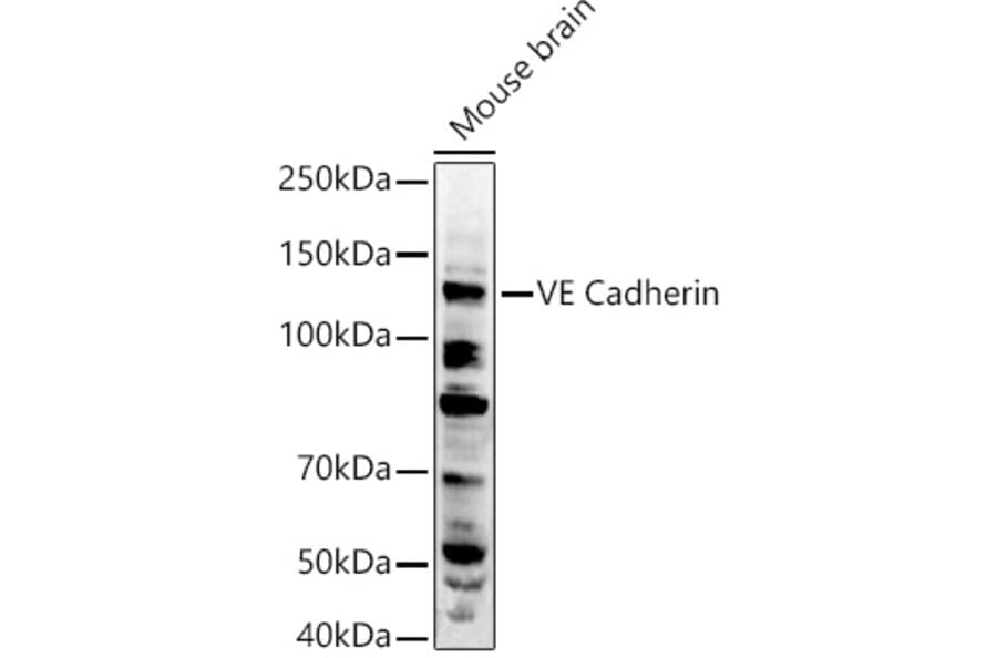Western Blot - Anti-VE Cadherin Antibody (A11187) - Antibodies.com