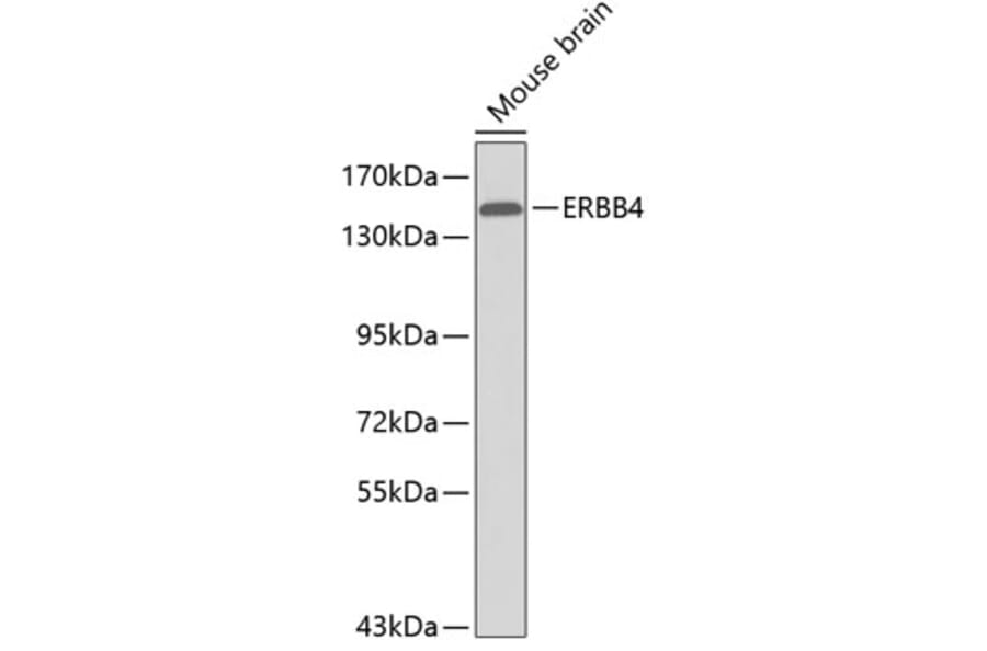 Western Blot - Anti-ERBB4 Antibody (A0750) - Antibodies.com