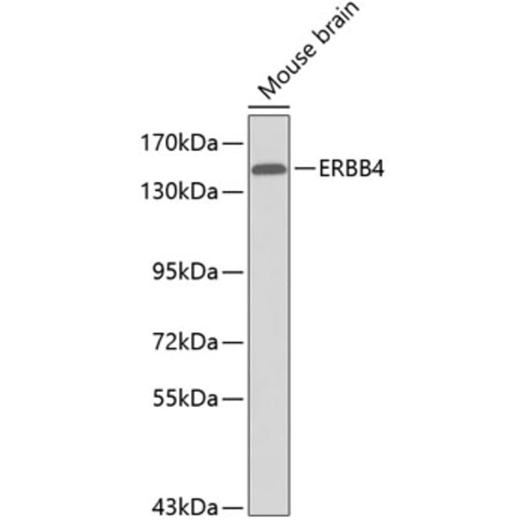 Western Blot - Anti-ERBB4 Antibody (A0750) - Antibodies.com