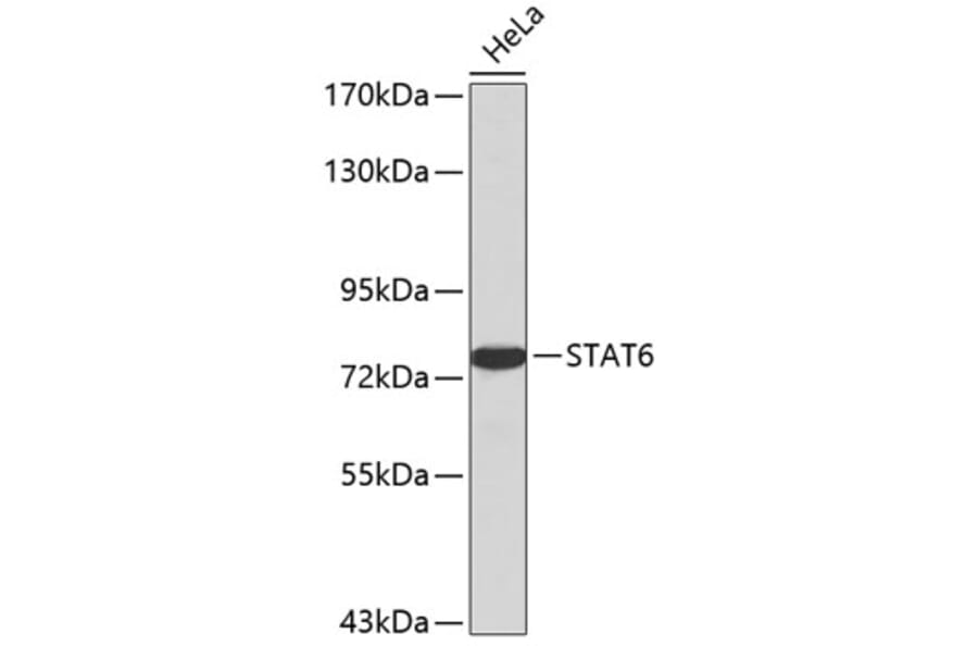 Western Blot - Anti-STAT6 Antibody (A0753) - Antibodies.com