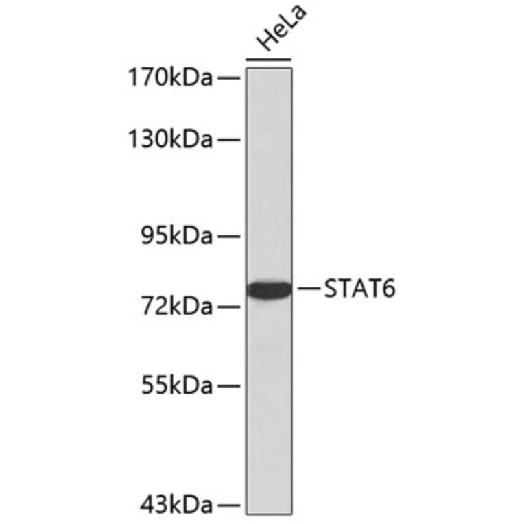 Western Blot - Anti-STAT6 Antibody (A0753) - Antibodies.com