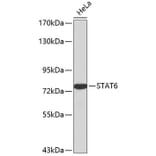 Western Blot - Anti-STAT6 Antibody (A0753) - Antibodies.com