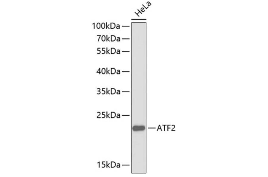 Western Blot - Anti-ATF2 Antibody (A0756) - Antibodies.com