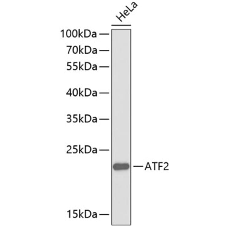 Western Blot - Anti-ATF2 Antibody (A0756) - Antibodies.com