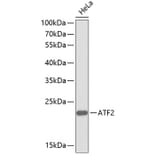 Western Blot - Anti-ATF2 Antibody (A0756) - Antibodies.com