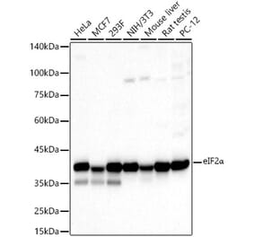 Western Blot - Anti-EIF2S1 Antibody (A11192) - Antibodies.com