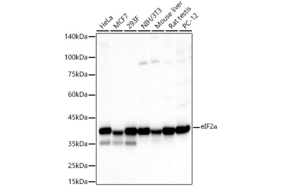 Western Blot - Anti-EIF2S1 Antibody (A11192) - Antibodies.com