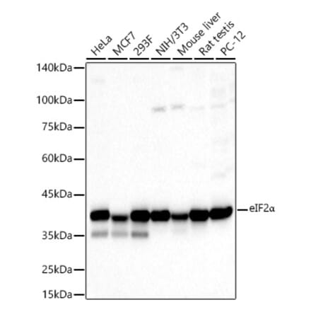 Western Blot - Anti-EIF2S1 Antibody (A11192) - Antibodies.com