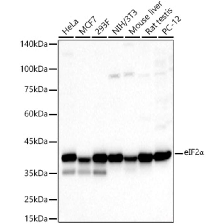 Western Blot - Anti-EIF2S1 Antibody (A11192) - Antibodies.com