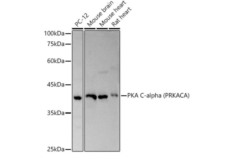 Western Blot - Anti-cAMP Protein Kinase Catalytic subunit alpha Antibody (A11194) - Antibodies.com