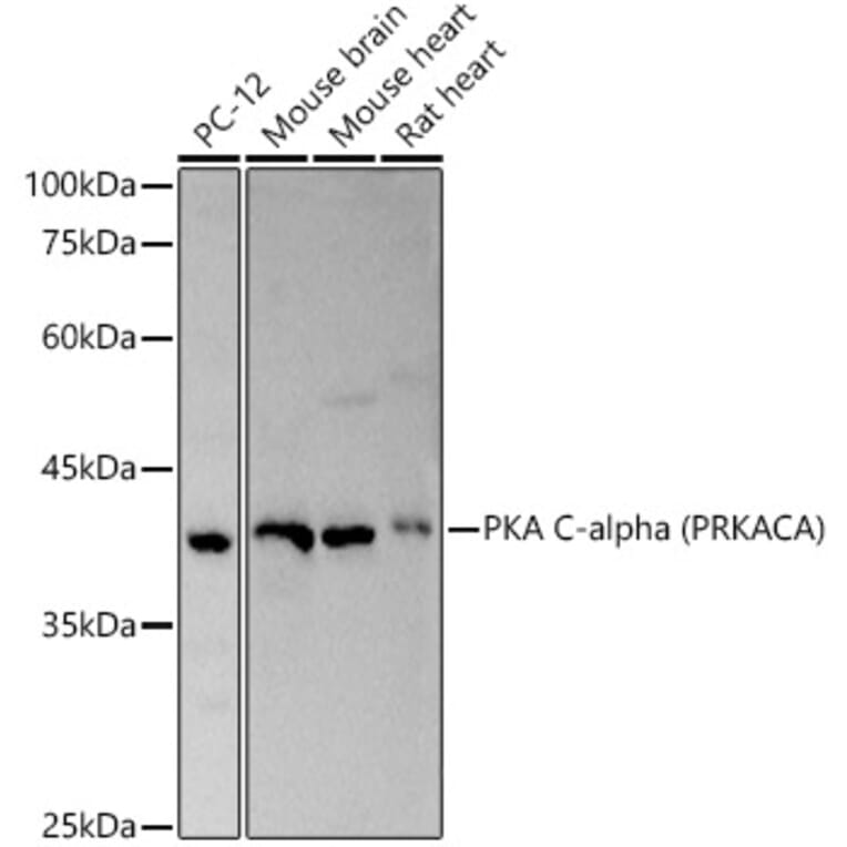 Western Blot - Anti-cAMP Protein Kinase Catalytic subunit alpha Antibody (A11194) - Antibodies.com