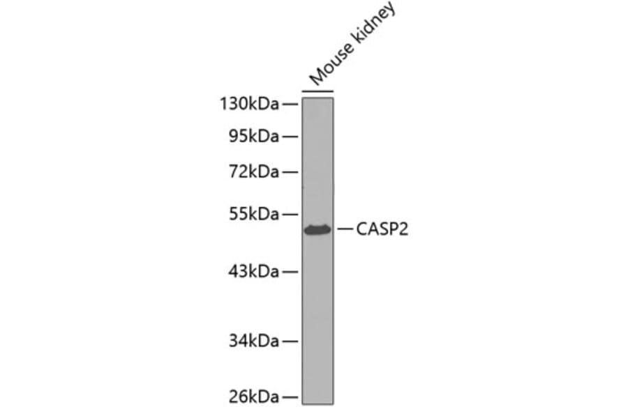 Western Blot - Anti-CASP2 Antibody (A0812) - Antibodies.com
