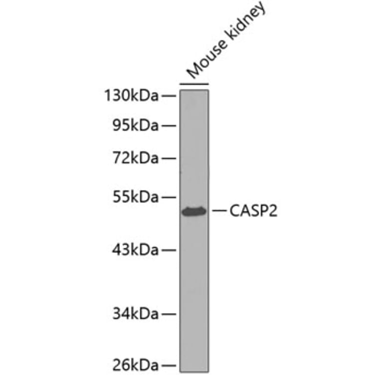 Western Blot - Anti-CASP2 Antibody (A0812) - Antibodies.com