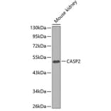 Western Blot - Anti-CASP2 Antibody (A0812) - Antibodies.com