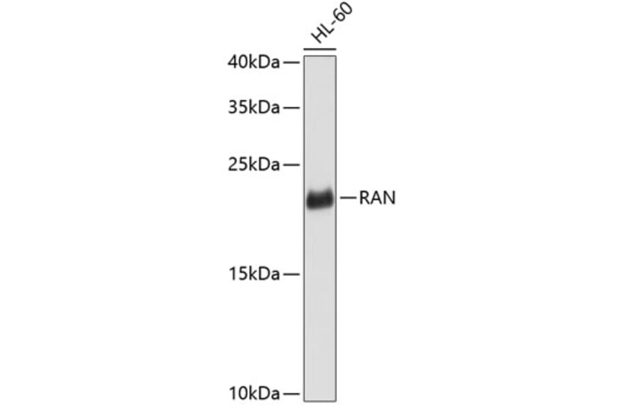 Western Blot - Anti-RAN Antibody (A0819) - Antibodies.com