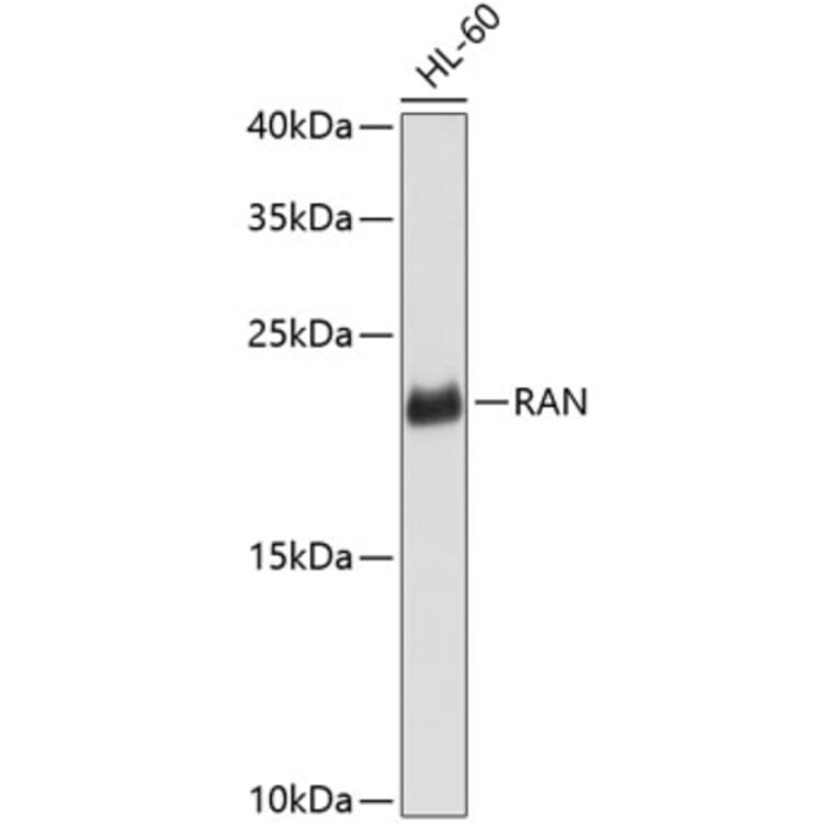 Western Blot - Anti-RAN Antibody (A0819) - Antibodies.com