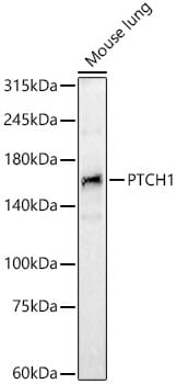 Western blot analysis of extracts of various cell lines, using Anti-PTCH1 Antibody (A0826) at 1:1,000 dilution.
Secondary antibody: Goat Anti-Rabbit IgG (H+L) (HRP) (AS014) at 1:10,000 dilution.
Lysates / proteins: 25µg per lane.
Blocking buffer: 3% non-fat dry milk in TBST.
Detection: ECL Basic Kit (RM00020).
Exposure time: 90s.