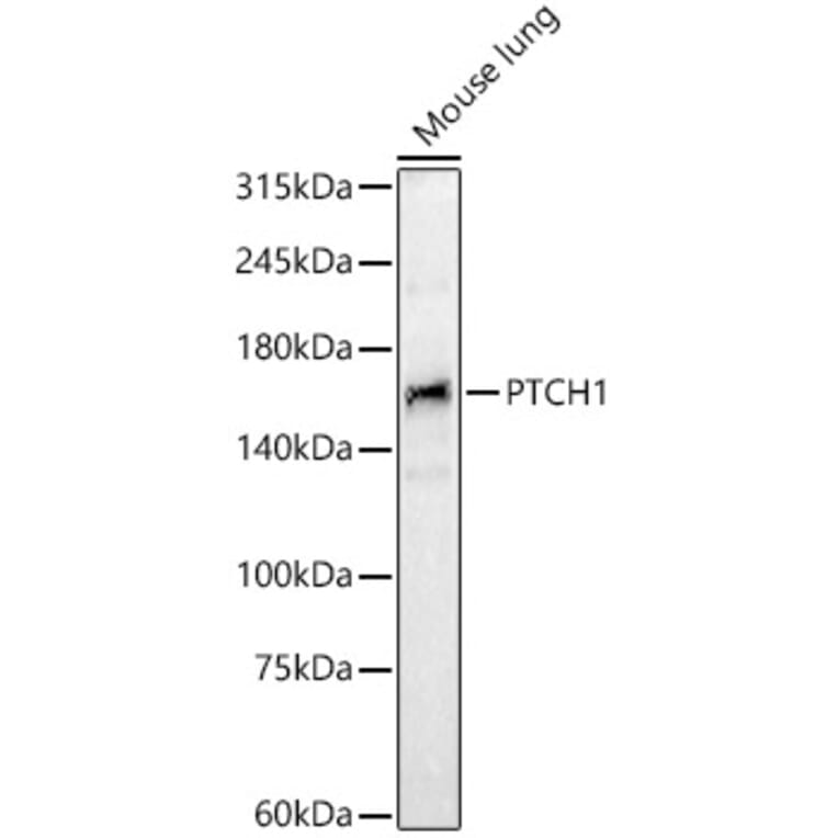 Western Blot - Anti-Patched / PTCH1 Antibody (A11198) - Antibodies.com