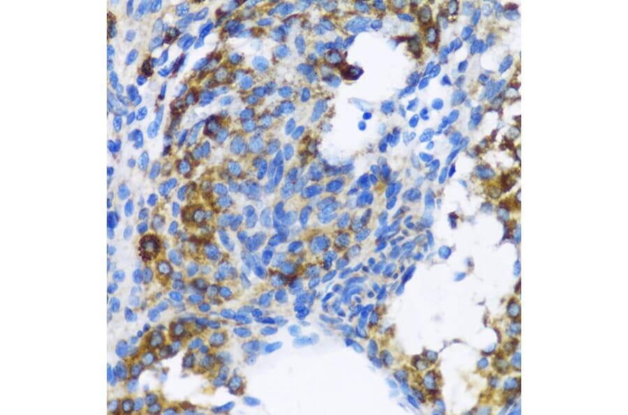 Immunohistochemistry - Anti-Patched / PTCH1 Antibody (A11198) - Antibodies.com