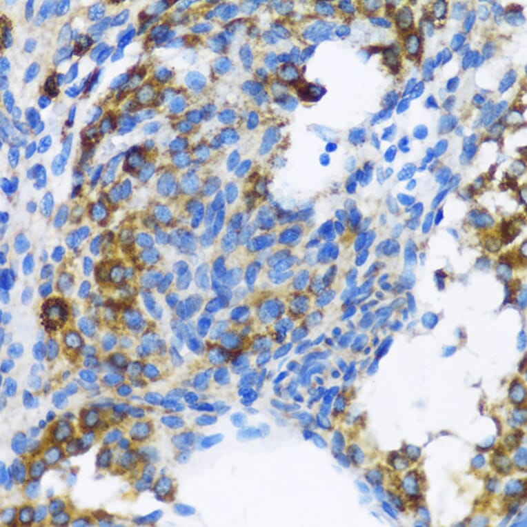 Immunohistochemistry - Anti-Patched / PTCH1 Antibody (A11198) - Antibodies.com
