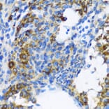 Immunohistochemistry - Anti-Patched / PTCH1 Antibody (A11198) - Antibodies.com