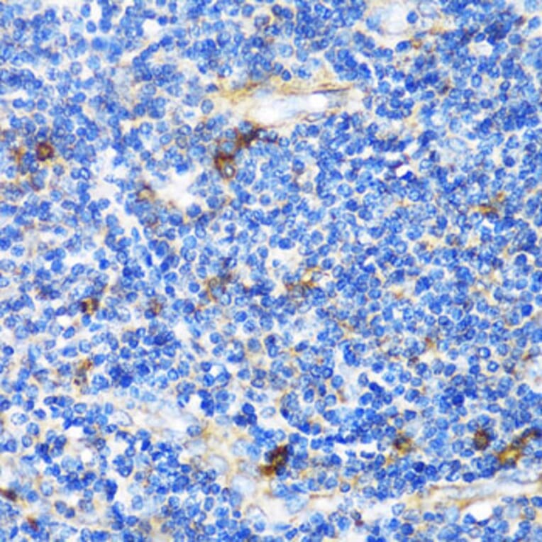 Immunohistochemistry - Anti-Patched / PTCH1 Antibody (A11198) - Antibodies.com