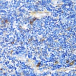 Immunohistochemistry - Anti-Patched / PTCH1 Antibody (A11198) - Antibodies.com