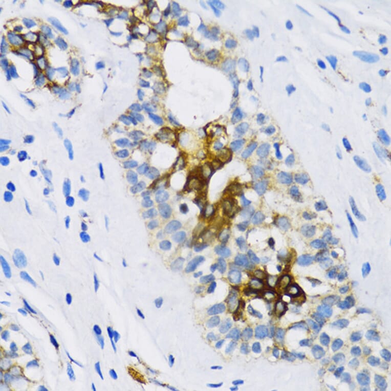 Immunohistochemistry - Anti-Patched / PTCH1 Antibody (A11198) - Antibodies.com