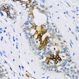 Immunohistochemistry - Anti-Patched / PTCH1 Antibody (A11198) - Antibodies.com