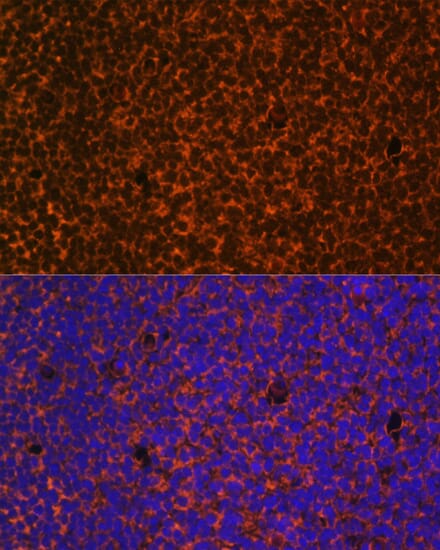 Immunofluorescence analysis of C6 cells using Anti-PTCH1 Antibody (A0826) at dilution of 1:100. Blue: DAPI for nuclear staining.