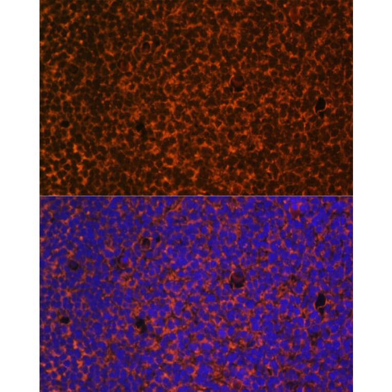 Immunofluorescence - Anti-Patched / PTCH1 Antibody (A11198) - Antibodies.com