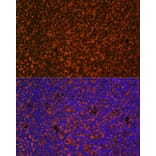 Immunofluorescence - Anti-Patched / PTCH1 Antibody (A11198) - Antibodies.com