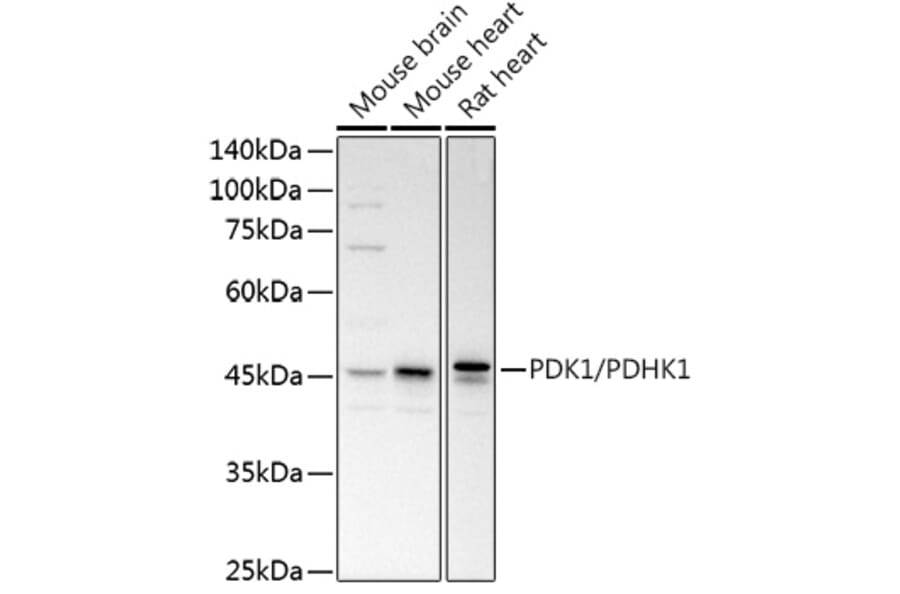 Western Blot - Anti-PDK1 Antibody (A11200) - Antibodies.com