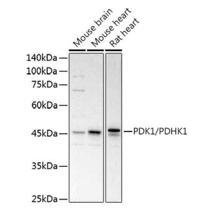 Western Blot - Anti-PDK1 Antibody (A11200) - Antibodies.com