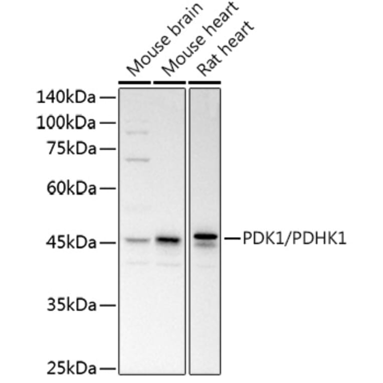 Western Blot - Anti-PDK1 Antibody (A11200) - Antibodies.com